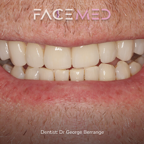 Amazing Results1