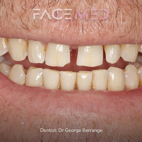 Amazing Results2